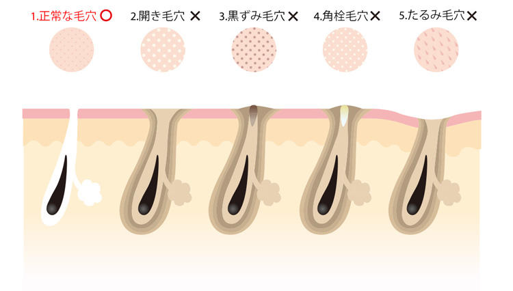 「毛穴」が残念な男は、脂ぎって老け顔に…どうすれば？