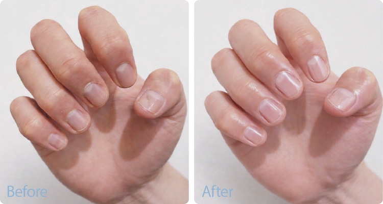 before & After